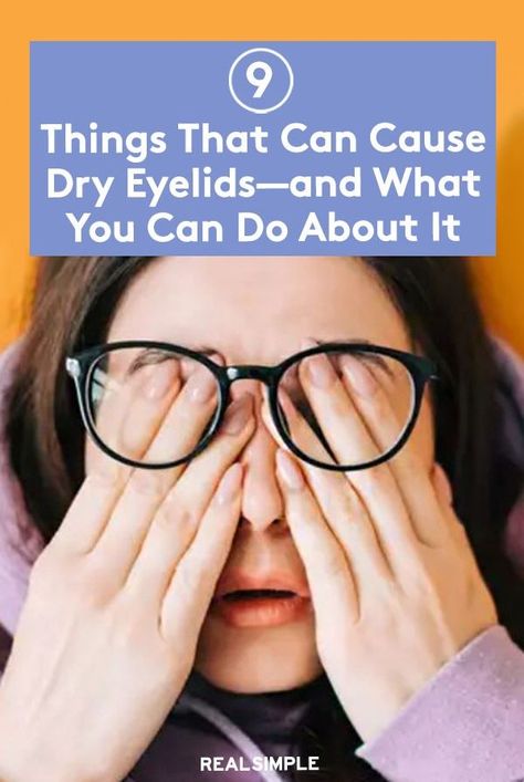 What can cause dry, flaky eyelids—and how do you treat them? Dermatologists are here to explain. Dry Skin Around Eyes Remedies, Dry Eye Lids, Eyelid Irritation Remedies, Crepey Eyelids Remedy, Eyelid Excema, Dry Eyes Remedy How To Get Rid, Dry Eyelids Remedy, Dry Flaky Eyelids, Dry Skin Around Eyes