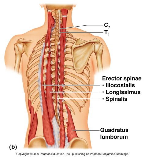 Erector Spinae Muscles Erector Spinae Muscles, Back Muscles Anatomy, Anatomy Muscles, Erector Spinae, Quadratus Lumborum, Muscles Of The Neck, Vertebral Column, Lower Back Muscles, Musculoskeletal System