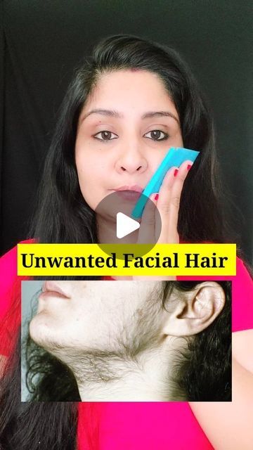 Homemade Hair Removal, Diy Facial Hair Removal, To Remove Facial Hair, Upper Lip Hair, Face Hair Removal, Hair Removal Diy, Hair Removal Remedies, Underarm Hair Removal, Unwanted Facial Hair