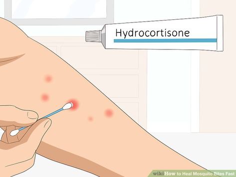 How To Soothe Mosquito Bites, How To Treat Mosquito Bits, How To Heal Mosquito Bites Fast, How To Get Rid Of Bug Bites Fast, How To Heal Bug Bites Fast, Heal Mosquito Bites Fast, How To Stop Mosquito Bites From Itching, Itchy Mosquito Bite Remedy, How To Get Rid Of Mosquito Bites Fast