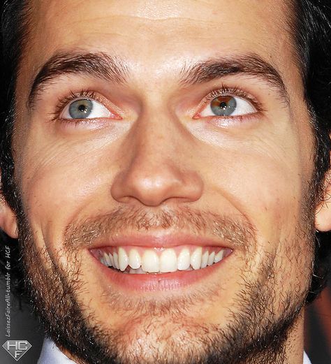 Actor Henry Cavill has sectoral heterochromia in his left eye.  It is mostly blue, with a couple of brown streaks. Henry Cavill Smile, Henry Cavill Superman, Heterochromia Eyes, Henry Cavill Eyes, Different Colored Eyes, Love Henry, Henry Williams, Le Male, Clark Kent