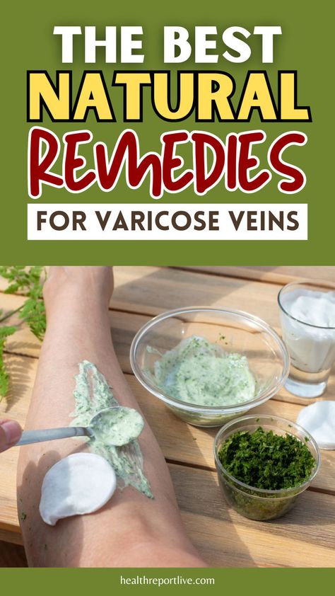 Here is a person's leg with a spoon and a bowl of food on it Vericous Veins, Vein Health, Regrow Hair Naturally, Varicose Vein Remedy, Leg Veins, Horse Chestnut, Compression Stockings, Natural Healing Remedies, Regrow Hair