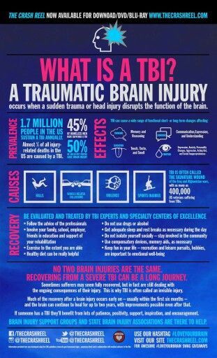 Post Concussion Syndrome, Brain Facts, Injury Recovery, Neurological Disorders, Brain Damage, Brain Power, Brain Health, Health Awareness, Chronic Pain