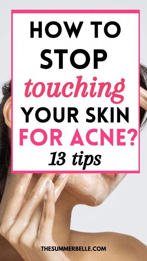 Clear Skin Overnight, Back Acne Remedies, Cystic Acne Remedies, Overnight Acne Remedies, Face Mapping Acne, Skincare Guide, Bad Acne, Pimples Remedies, Pimples On Face