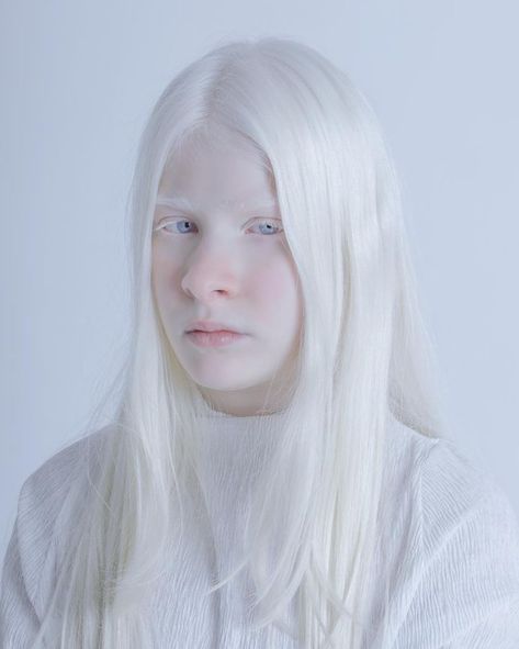 Albino Skin, Albino Rabbit, ليلي كولينز, Albino Girl, Coquette Girl, Platinum Hair, Aesthetic People, Face Photo, Jolie Photo