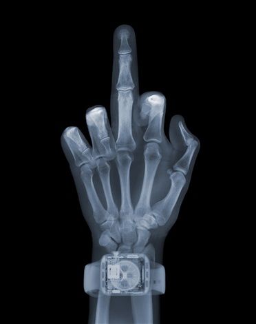 Nick Veasey's X-ray Art: See Things as They Really Are - Arte & Lusso Vincent Black Shadow, Xray Art, Photography Artists, X Rays, Art Street, Abstract Photography, Contemporary Art Gallery, Contemporary Artwork, British Artist