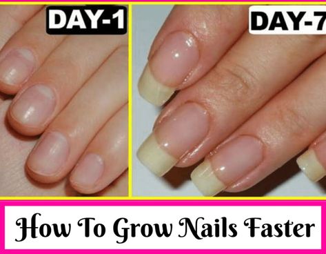 Make Nails Grow, Nail Growth Faster, Grow Long Nails, Nail Growth Tips, Grow Nails Faster, Fast Nail, Heal Cavities, Nagel Tips, Brittle Nails