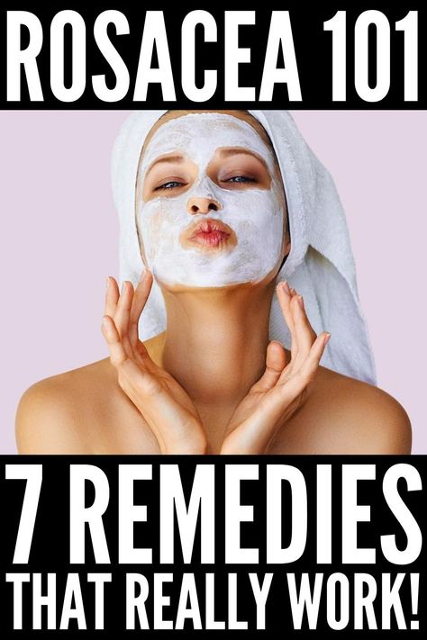 How To Treat Redness On Face, How To Get Rid Of Rosy Cheeks, How To Cover Redness On Face, Get Rid Of Redness On Face, Rosatia Remedies, Red Cheeks Remedy, Red Face Remedies, Roscea Help, How To Get Rid Of Redness On Face