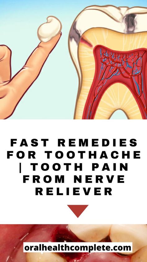 Fast Remedies For Toothache | Tooth Pain From Nerve Reliever