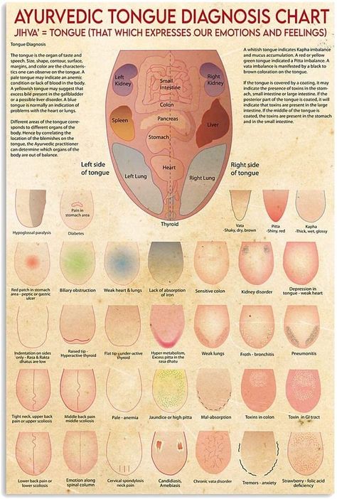 PRICES MAY VARY. Measure approximately sizes:8x12 inch(20x30 cm) Material:Ayurveda Tongue Diagnosis Chart Metal Tin Sign.The wall decorative signs is made of Aluminum/Tin metal.Durable,waterproof,high temperature resistance. Easy to install:The metal sign comes with 4 pre-drilled holes in the corners,can be mounted on the wall by nails on 4 corners or double-sided tape or blu--tack. Perfect Decoration: The metal signs is very suitable for bathroom, living room, bedroom, kitchen, classroom, guest Tongue Diagnosis Chart, Kitchen Classroom, Knowledge Poster, Ayurvedic Healing, Tongue Health, Tin Metal, Holistic Lifestyle, Poster Home Decor, Medical Knowledge
