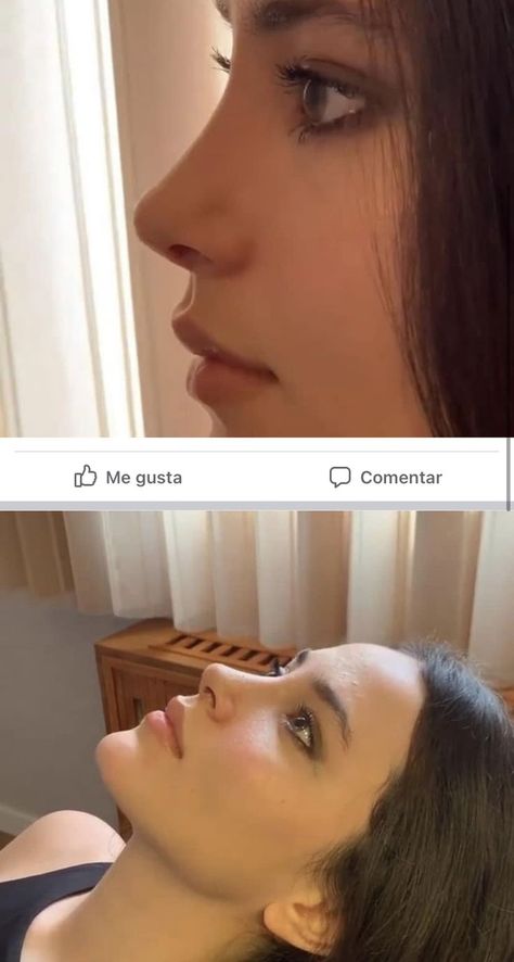 Nose Job Inspiration, Nose Types, Rhinoplasty Nose Jobs, Rhinoplasty Before And After, Job Inspiration, Pretty Nose, Corps Idéal, Perfect Nose, Flot Makeup