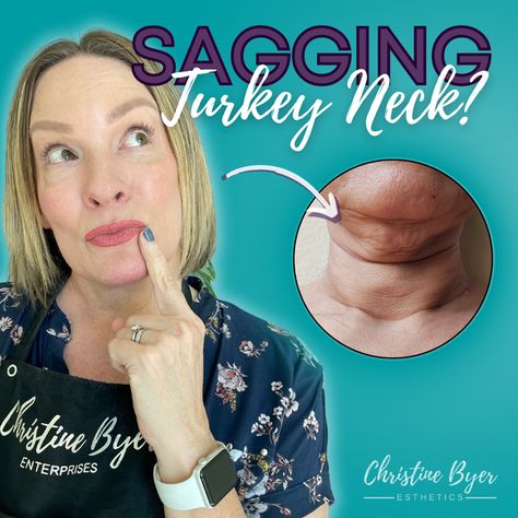 How To Tighten Turkey Neck, Sagging Neck Remedies, Natural Neck Lift, Getting Rid Of Turkey Neck Sagging Skin, Neck Lift Naturally, Chin Tightening Exercises, How To Get Rid Of A Turkey Neck, Tighten Neck Skin Double Chin, Neck Tightening Sagging Skin