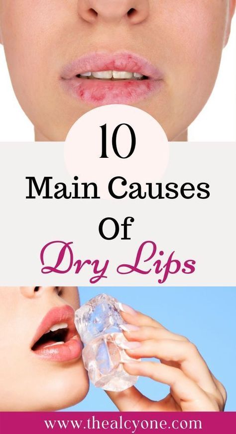 Dry Lips Remedy, Chapped Lips Remedy, Very Dry Lips, Dehydrated Lips, Dry Cracked Lips, Skin Moles, Lip Care Routine, Cracked Lips, Peeling Skin