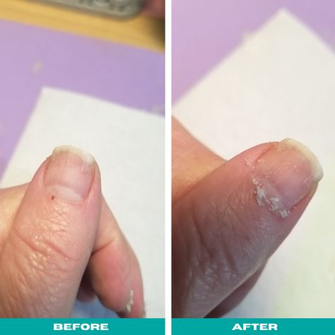 Cuticles Before And After, How To Trim Your Cuticles, Nail And Cuticle Care, Dry Cuticles How To Get Rid Of, How To Trim Cuticles At Home, Cuticle Remover Homemade, Bad Cuticles, Peeling Cuticles, Cuticle Repair