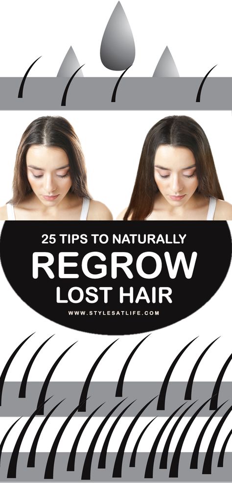 Best Hair Regrowth Products For Women, Hair Regrowth Tips, Regrow Lost Hair, Hair Regrowth Remedies, Regrow Hair Naturally, Stop Hair Breakage, Hair Repair Treatments, Healthy Natural Hair Growth, Hair Growth Secrets