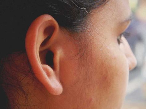 Why Do the Backs of My Ears Smell? Ears Reference Photography, Ears At Different Angles, Ears From Different Angles, Ear Perspective, Ear Angles, Ear Study Reference, Ears Reference Photography Angles, Ear Reference Photo, Ear To Ear Closure