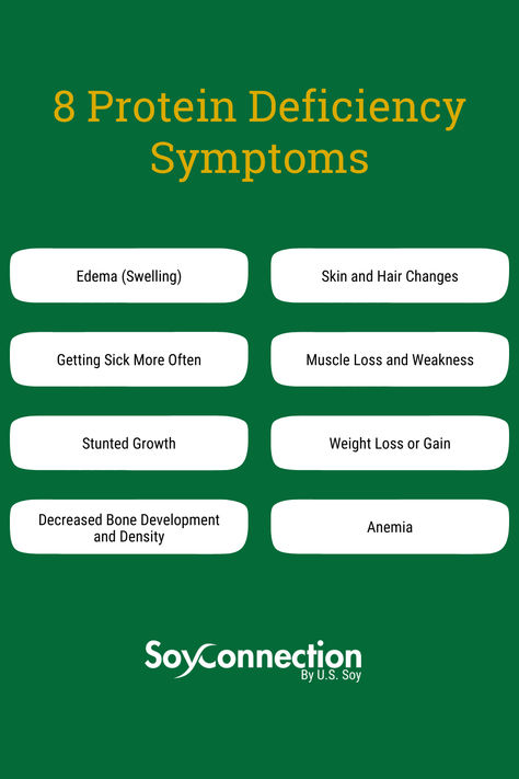 ⭐ 8 Protein Deficiency Symptoms ⭐⁣ 🔸Edema⁣ 🔸Skin and Hair Changes⁣ 🔸Getting Sick More Often⁣ 🔸Muscle Loss and Weakness⁣ 🔸Decreased Bone Development and Density⁣ 🔸Stunted Growth⁣ 🔸Weight Loss or Gain⁣ 🔸Anemia⁣ ⁣ Boost your protein with animal and plant-based sources. This article by health.com suggests several soy protein products like edamame, soymilk, tofu, tempeh and plant-based protein powders. ⁣ Protein Deficiency Symptoms, Protein Deficiency, Protein Products, Deficiency Symptoms, Plant Based Protein Powder, Protein Powders, Soy Protein, Tempeh, Plant Based Protein