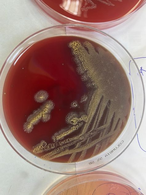 Pseudomonas aeruginosa on 5% Sheep blood agar #pseudomonas #microbiology #clinical #biology #science #genetics #bacteria #pathologic Science Genetics, Pseudomonas Aeruginosa, Biology Science, Medical Laboratory, Microbiology, Medical Students, Biology, Sheep, Medical