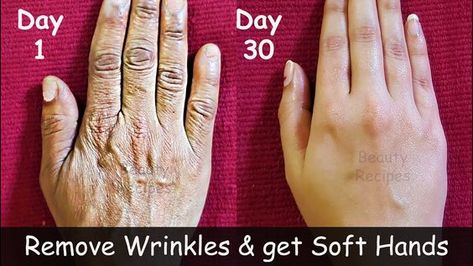 Remove Wrinkles From Hands, Forehead Wrinkles Remedies, Baking Soda Teeth, Hands Care, Clean Skin Face, Wrinkles Hands, Dark Elbows, Scrub Diy, Wrinkle Remedies