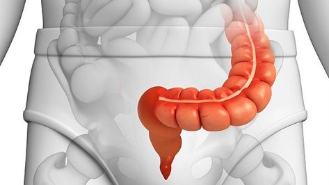 How Diverticulitis Affects the Sigmoid Colon Postnatal Massage, Sigmoid Colon, Regular Bowel Movements, Bowel Movement, Natural Colon Cleanse, Prenatal Care, Irritable Bowel, Respiratory Health, Large Intestine