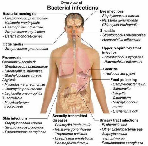 Nurse Rock, Nursing School Studying, Nursing School Notes, Nursing Tips, Nursing Study, Bacterial Infection, Nursing Education, Nursing Notes, Medical Knowledge