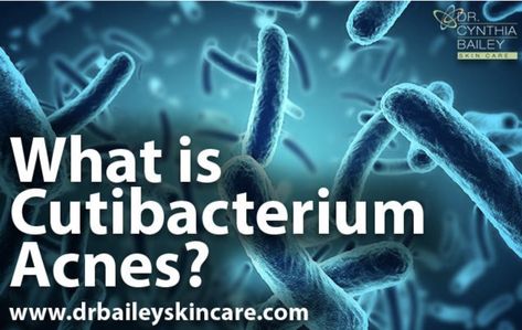 What is Cutibacterium Acnes? Cutibacterium acnes is the new name for the acne-causing germ Propionibacterium acnes, or P. acnes for short. Learn more about C. acne and the best products to treat acne vulgaris and black heads from board certified dermatologist Dr. Cynthia Bailey. https://drbaileyskincare.com/blogs/blog/what-is-cutibacterium-acnes #ACNE #acnevulgaris #pacnes #cacne #CutibacteriumAcnes #blackheads #oilyskin #greasyskin #pimples Benzoyl Peroxide Cleanser, Scalp Acne, Chest Acne, Cynthia Bailey, Acne Vulgaris, Black Heads, Body Acne, Treat Acne, Acne Facial