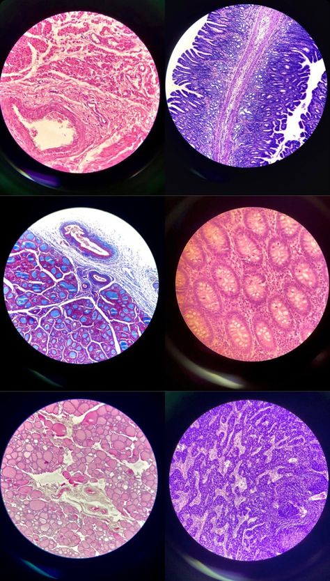 I am here to manifest me passing, learning, and excelling in Histology and every other subject🫡 Nuclear Medicine Aesthetic, Exercise Science Major Aesthetic, Medical Laboratory Science Aesthetic, Biological Sciences Aesthetic, Cellular Biology Aesthetic, Biophysics Aesthetic, Chemicals Aesthetic, Lab Aesthetic Science, Bio Medical Engineering