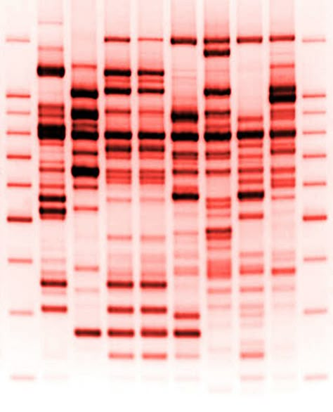 DNA RedHiRes ~ Dna Microscope, Dna Aesthetic, Dna Pattern, Science Pattern, Dna Sequencing, Dna Facts, Dna Analysis, Dna Art, Dna Strand