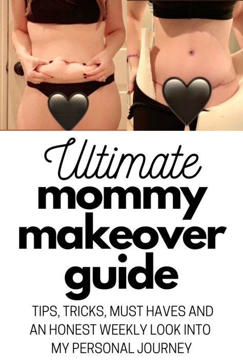 Ultimate Mommy Makeover Guide: Everything You Need to Know - Mommy Makeover Surgery Recovery, Plastic Surgery Recovery, Body Lift Surgery, Tummy Tucks Recovery, Mom Makeover, Skin Removal Surgery, Mommy Makeover Surgery, Body Makeover, Sleeve Surgery