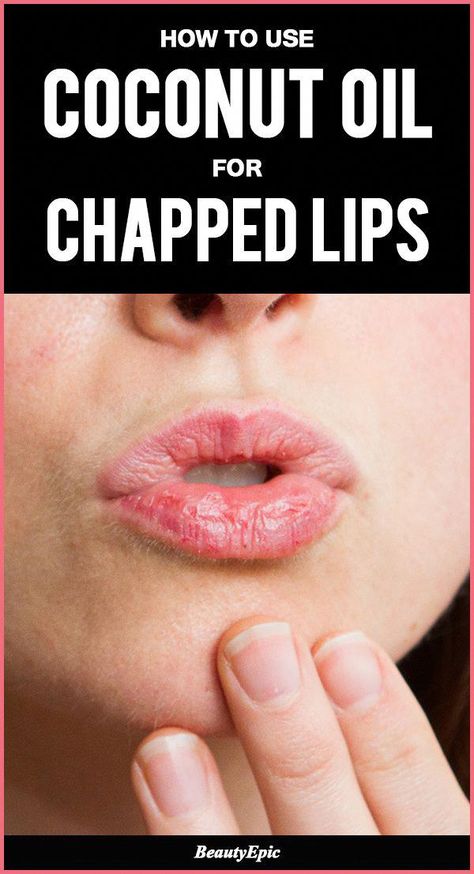 Chapped Lips Remedy, Treat Hyperpigmentation, Eyeshadow Basics, Lip Tips, Chemical Peels, Prom Makeup Looks, Fall Makeup Looks, Best Eyeshadow, Winter Makeup