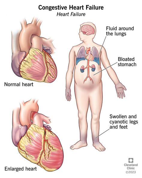 Best Cough Remedy, Alcohol Use Disorder, Cleveland Clinic, School Of Medicine, Mole, Disease, Portugal, Signs