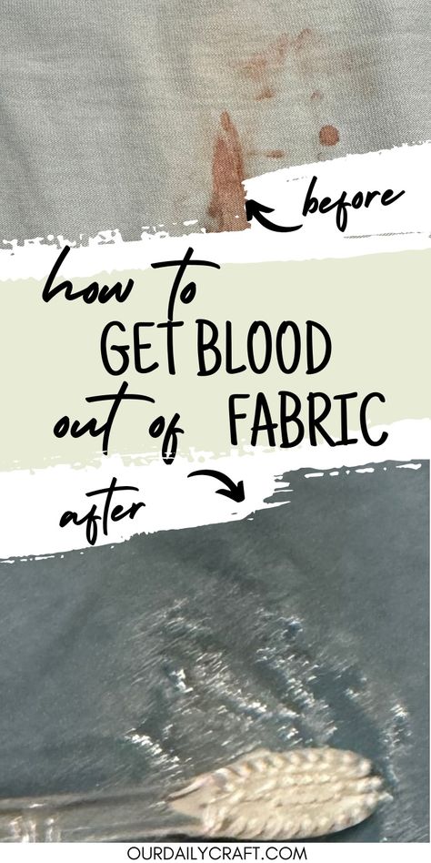 how to get blood out of fabric tutorial Blood Removal From Clothes, How To Get Dye Out Of Clothes, How To Remove Blood Stains From Clothing, How To Get Blood Out Of Clothes, Blood Out Of Clothes, Get Blood Stains Out, Blood Stain Removal, Diy Room Spray, All About Me Book