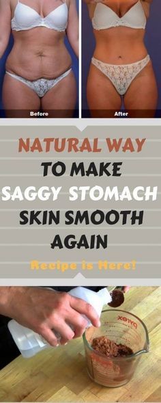 Tighten Loose Belly Skin, Tighten Stomach, Skin Firming Lotion, Skin Tightening Stomach, Loose Belly, Tighten Loose Skin, Skin Bumps, Healthy Wraps, Saggy Skin