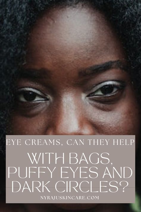 Dark And Puffy Under Eyes, Best Product For Dark Circles Under Eyes, How To Get Rid Of Bags Under Eyes Fast, Under Eye Puffiness Remedies, Eye Cream For Puffy Eyes Bags, Puffy Under Eyes Bags, Eye Dark Circles Remedies, How To Get Rid Of Dark Circles Under Eye, Remove Bags Under Eyes