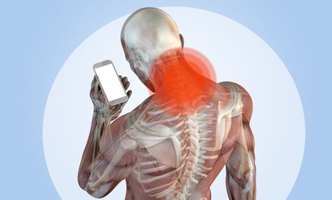 How to Get Rid of Tech Neck in 5 Steps Get Rid Of Tech Neck, Trout Salad, Smoked Trout Salad, Muscles Anatomy, Repetitive Strain Injury, Text Neck, Tech Neck, Pinched Nerve, Celery Root