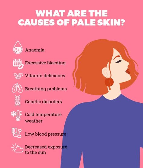 What are the causes of pale skin? Pale Skin Tips How To Get, How To Get More Pale Skin, Pale Skin Subliminal Result, Funny Pale Skin Memes, Pale Skin Is So Angelic, Rare Genetic Disorders, Vitamin Deficiency, Natural Skin Tone, Genetic Disorders