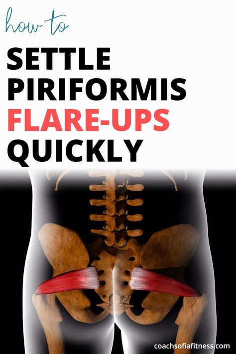 Piriformis Exercises, Piriformis Syndrome Exercises, Nerve Pain Remedies, Vitamins For Nerves, Inner Knee Pain, Piriformis Muscle, Piriformis Stretch, Piriformis Syndrome, Sciatica Pain Relief