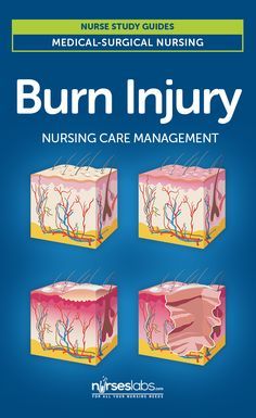 Burn Injury Nursing Care Management and Study Guide Nursing School Clinicals, What Is Nursing, Nurse Practitioner School, Nursing School Prerequisites, Medical Study, Burn Injury, Nursing Study Guide, Care Management, Nursing Care Plan