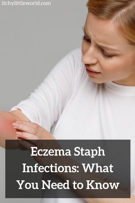 Skin Infections Types Of, Throat Infection, Sinus Congestion, Skin Care Lotions, Sinus Infection, Stomach Ache, Itchy Skin, Skin Problems, Body Health