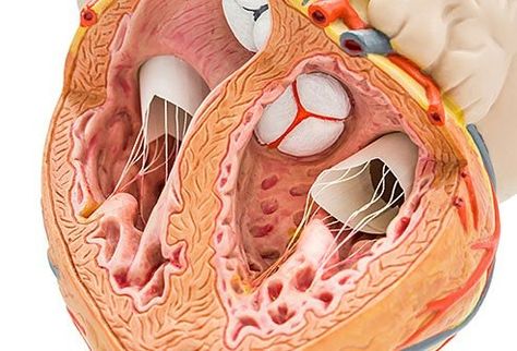 Cardiac (heart) ablation is a minimally invasive procedure that uses radiofrequency energy to destroy small areas of heart tissue that cause irregular heartbeats. Heart Ablation, Ablation Surgery, Heart Structure, Heart Valves, High Cholesterol Levels, Best Nursing Schools, Heart Function, Coronary Arteries, Heart Problems