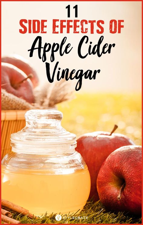 Acv Benefits, Apple Cider Vinegar Remedies, Vinegar Benefits, Vinegar Rinse, Apple Cider Vinegar Benefits, Apple Cider Vinegar Drink, Apple Vinegar, Cold Sores Remedies, Natural Sleep Remedies