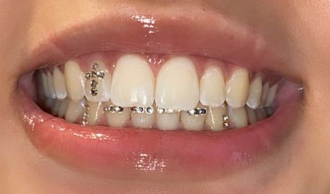 Tooth Gems Grill, Jems On Teeth, Bottom Tooth Gems Ideas, Cute Tooth Gem Ideas, Gems On Teeth, Grills For Women Teeth, Teeth Gems Ideas, Tooth Gem Ideas, Tooth Gems Aesthetic