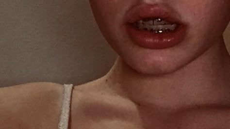 #aesthetic #lips #braces #teeth Teeth Aesthetic Braces, Brace Aesthetics, Teeth Braces Aesthetic, Bunny Teeth Aesthetic, Lips With Braces, Crooked Teeth Aesthetic, Braces Aesthetic Girl, Orthodontics Aesthetic, Aesthetic Braces