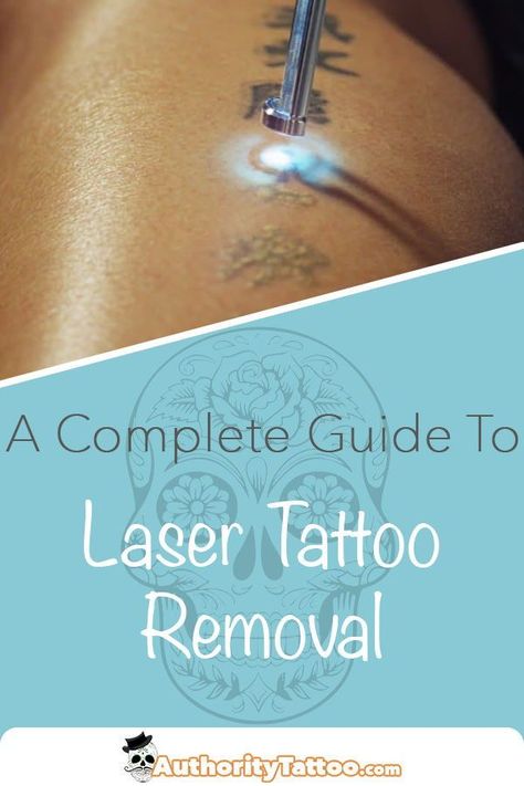 We all make mistakes, but when those mistakes are tattoos, they’re a whole lot harder to forget.  Well, we’ve got good news for you: with laser removal, a tattoo doesn’t have to be a life sentence.  If you’re thinking of getting a tattoo removed, click the pin. Our article covers all the basics you need to know before making your final decision. Are Tattoos, Hygiene Hacks, Tattoo Mistakes, Tattoo Removal Cost, Laser Removal, Getting A Tattoo, We All Make Mistakes, Laser Tattoo, Laser Tattoo Removal