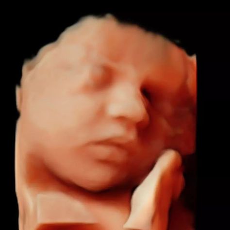 Arizona's Premier 3D/4D 5D Ultrasound Facility.  🤰 19+ Years In Serving All Of Arizona!  🤰 Visit our website for all our package information including current specials running now!  👉DNA Gender Determination Blood Draw At 6+ Weeks Along 😲 With Over 8 Years Of 100% Accuracy!❤ 👉Ultrasounds As Early As 10 Weeks Along and Starting At Just $40!❤ 480-421-BABY (2229)  480-221-9171 (Text Only Line)  MiracleViewUltrasound.com  #firsttrimester #secondtrimester #thirdtrimester   #5dultrasound #ge... Gender Determination, Second Trimester, Third Trimester, First Trimester, Ultrasound, Bump, Arizona, Running, 3rd Trimester