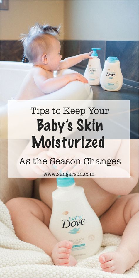 Baby Skin Care Tips, Newborn Skin Peeling, Baby Medicine, Baby Spa, Crazy Weather, Baby Care Products, Homemade Cleaning Solutions, Baby Soft Skin, Baby Facts