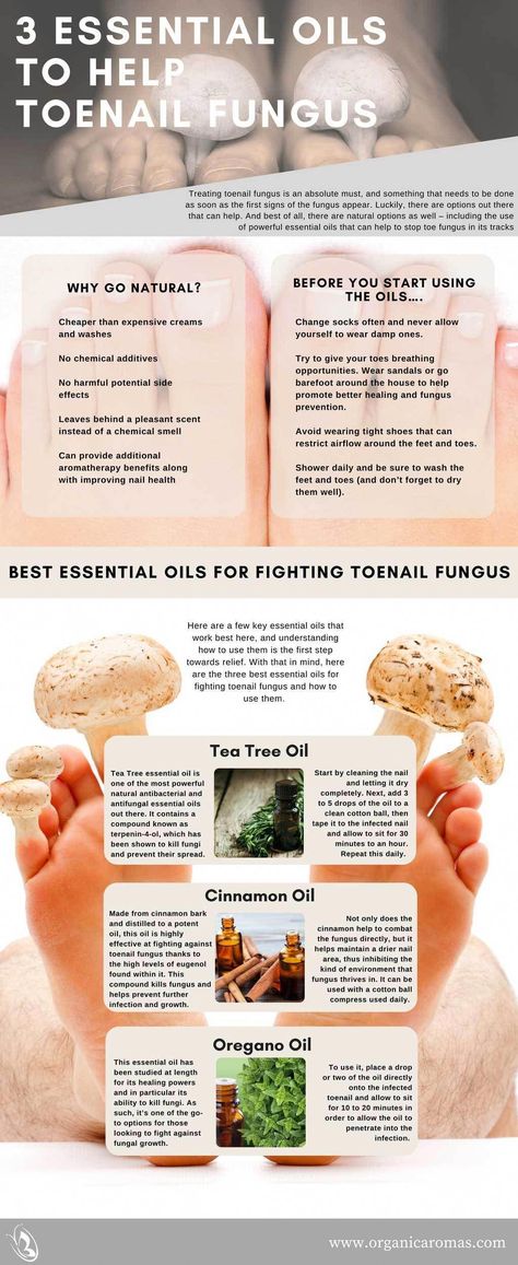 Essential Oils Techniques And Strategies For vegetarian food #vegetarianfood Treating Toenail Fungus, Natural Antifungal, Nagel Stamping, Toenail Fungus Remedies, Nail Fungus Remedy, Fungal Nail, Tongue Health, Nail Oil, Toenail Fungus