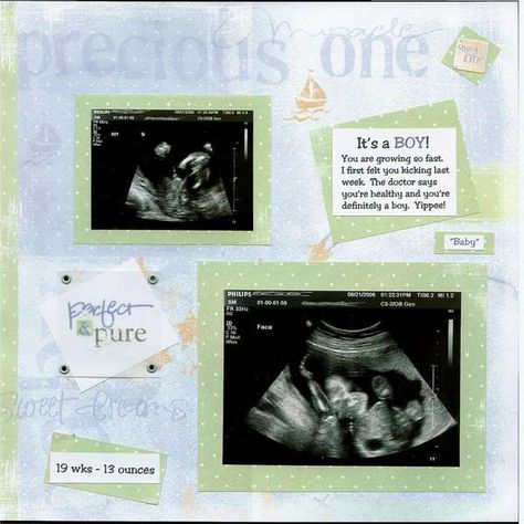 Pregnant Scrapbook Pages, Ultrasound Scrapbook, Pregnancy Scrapbook, Sonogram Pictures, Baby Books Diy, Scrapbook Photos, Baby Scrapbook Album, Baby Ultrasound