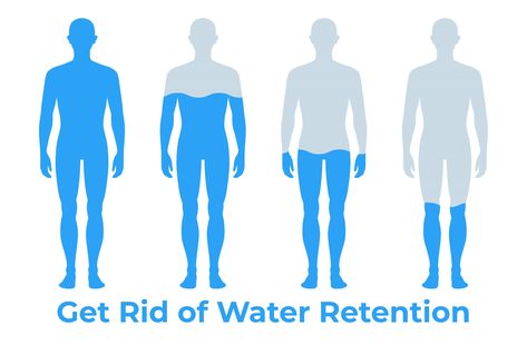 How to Get Rid Of Water Retention Fluid Retention Remedies, Water Retention Causes, Sweet Sweat Waist Trimmer, Water Retention Remedies, Lose Water Weight, Retaining Water, Swollen Legs, Fat Burning Supplements, Body Fluid