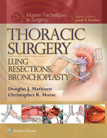 Thoracic Surgery, Cerebrospinal Fluid, General Surgery, Medicine Book, Disease Prevention, Science Books, Radiology, Health Science, Post It Notes